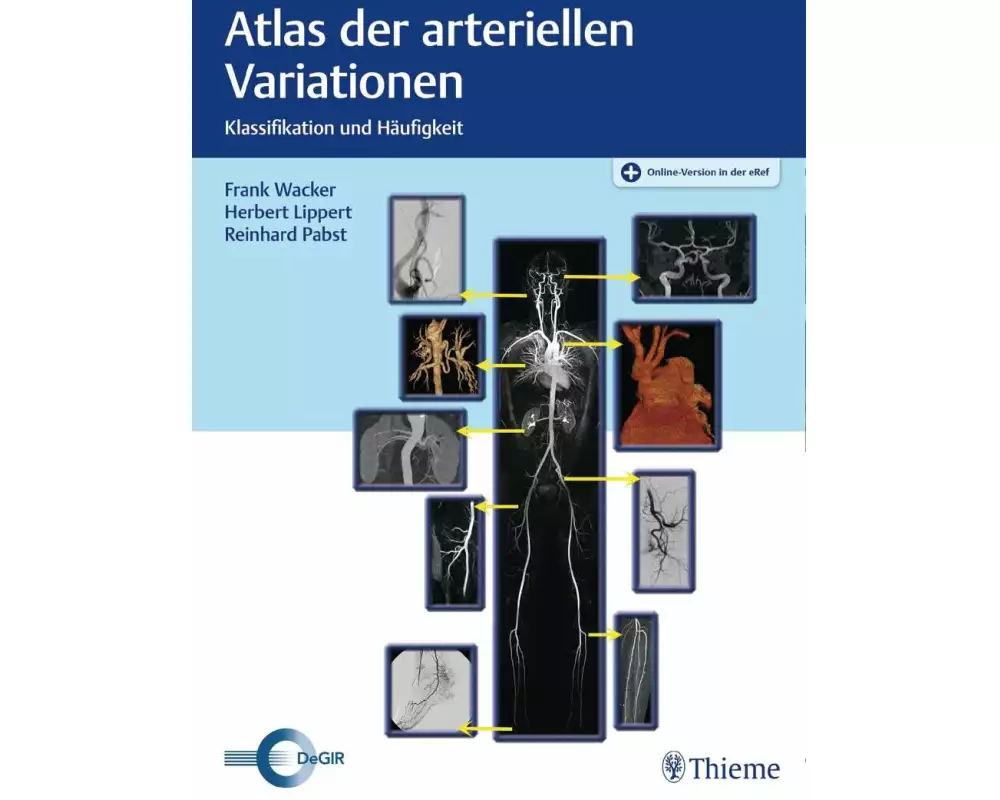 Atlas der arteriellen Variationen