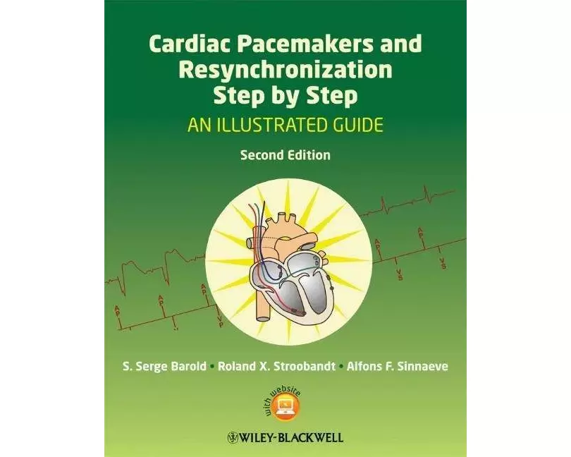 Cardiac Pacemakers and Resynchronization Step by Step
