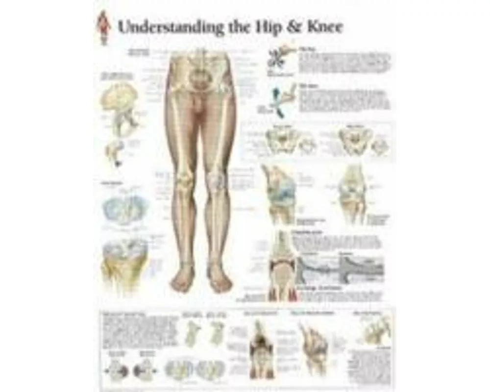 Understanding the Hip & Knee Laminated Poster