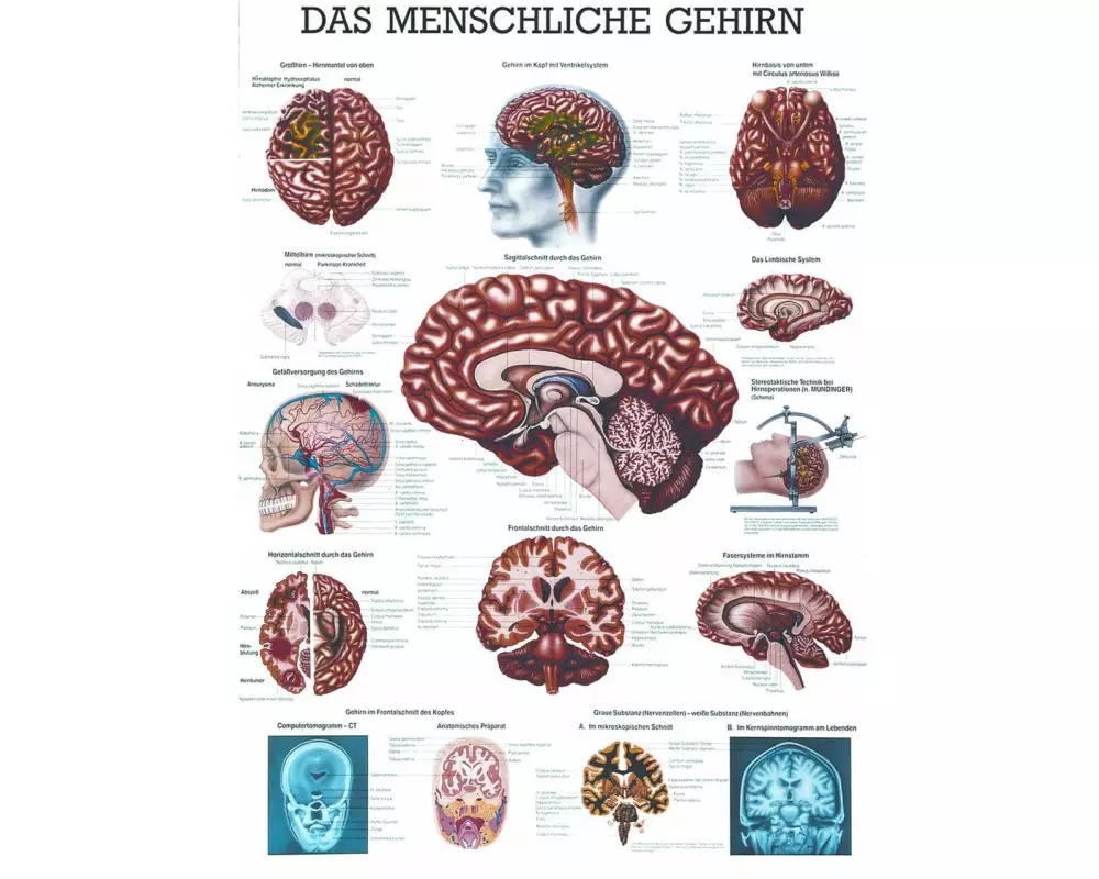 Rüdiger Anatomische Lehrtafel Das menschliche Gehirn 70 x 100 cm