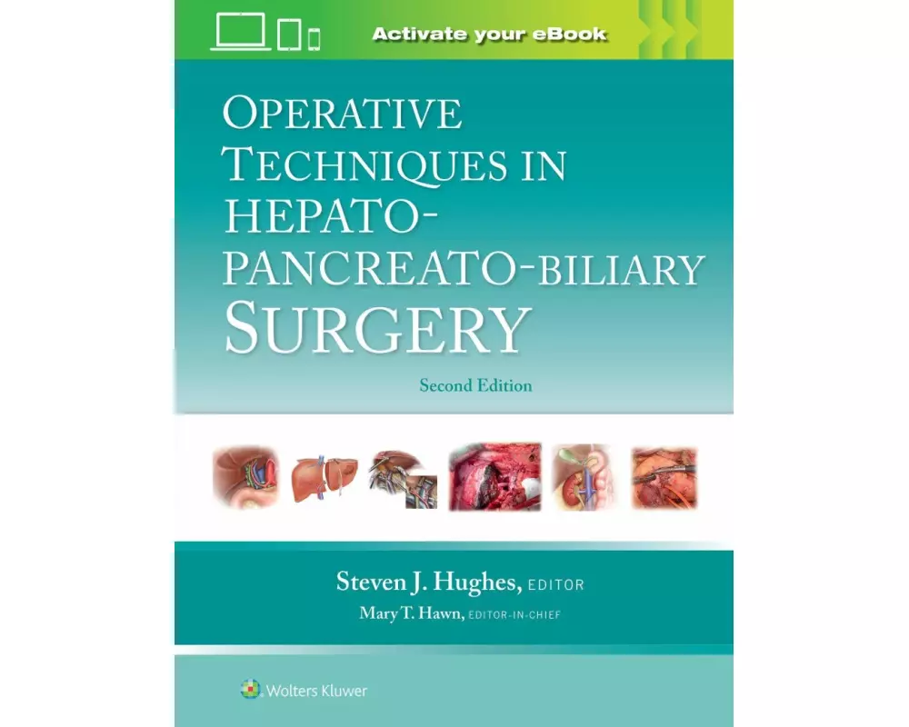 Operative Techniques in Hepato-Pancreato-Biliary Surgery: Print + eBook with Multimedia