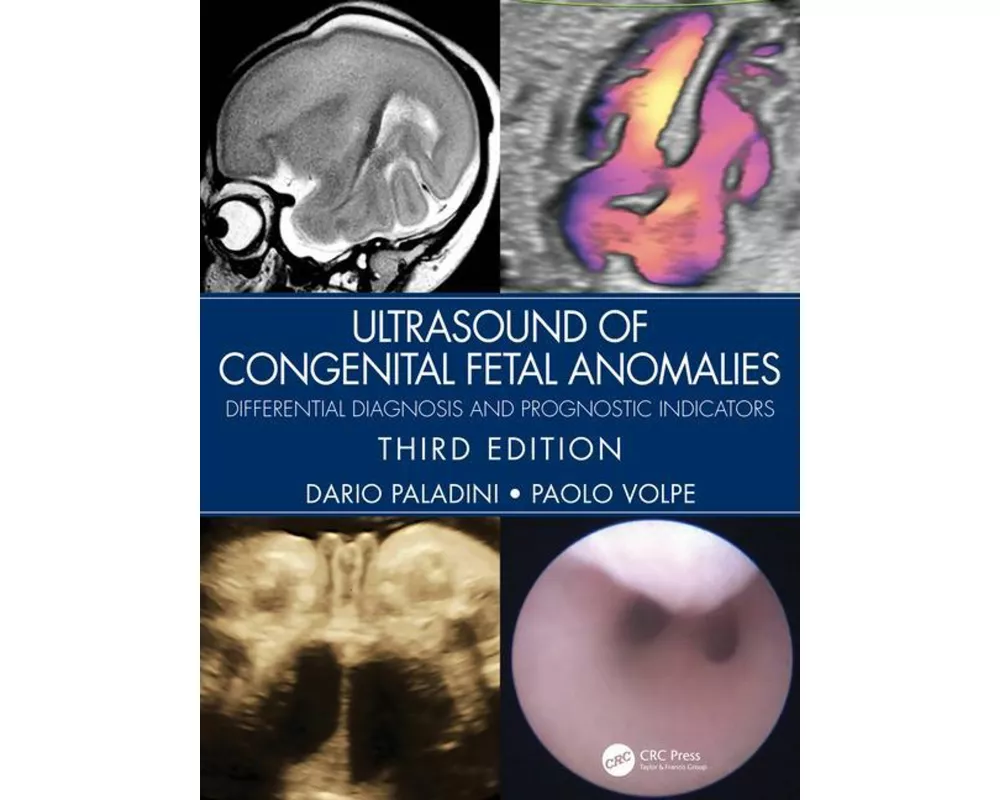 Ultrasound of Congenital Fetal Anomalies