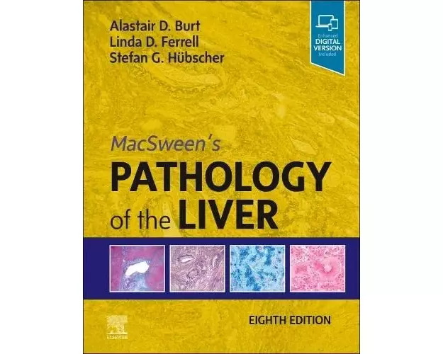 Macsween's Pathology of the Liver