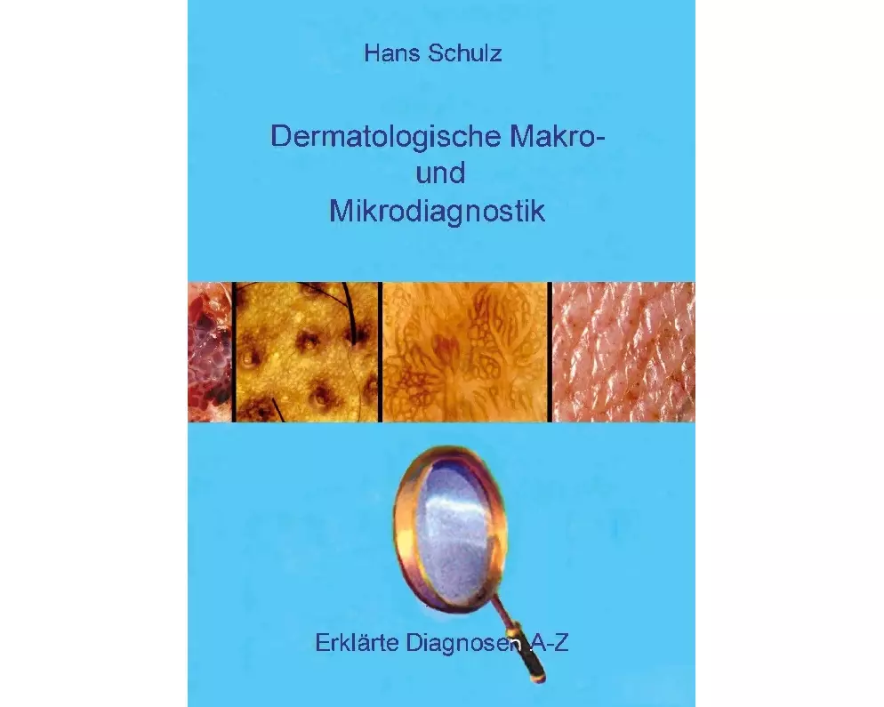 Dermatologische Makro- und Mikrodiagnostik