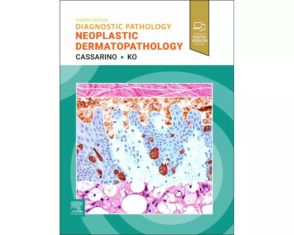 Diagnostic Pathology: Neoplastic Dermatopathology