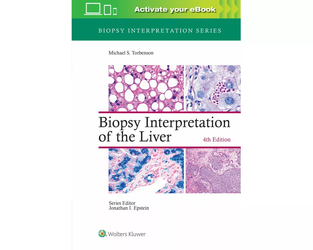 Biopsy Interpretation of the Liver