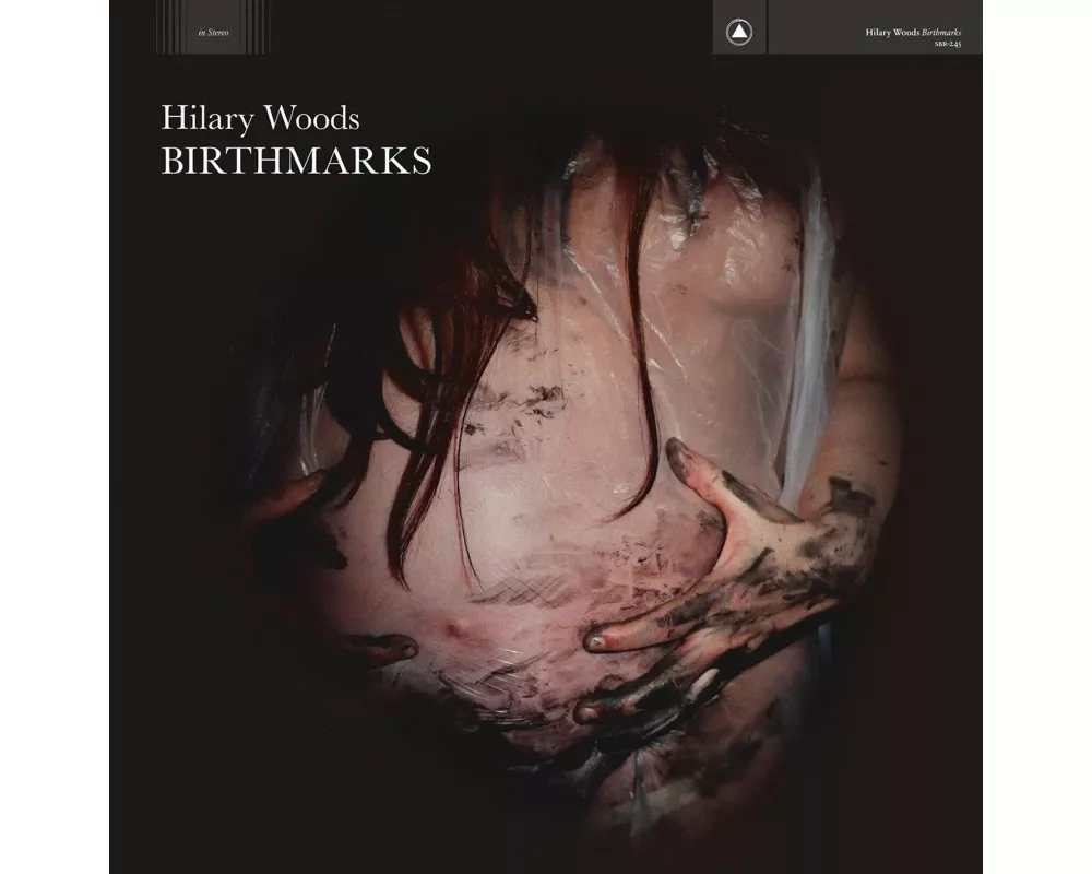 Birthmarks