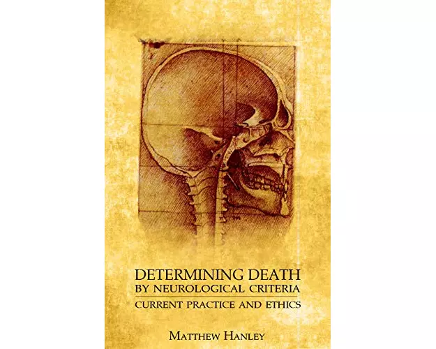 Determining Death by Neurological Criteria