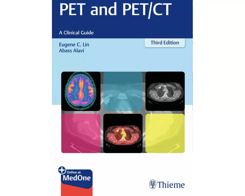 PET and PET/CT