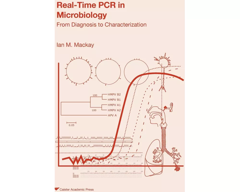 Real-time PCR in Microbiology
