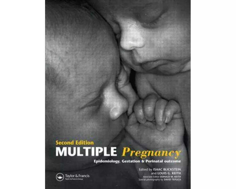 Multiple Pregnancy