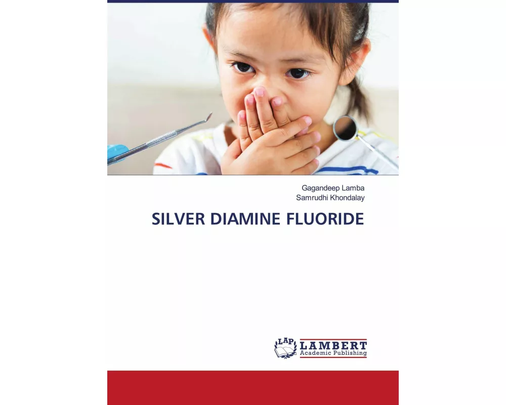 Silver Diamine Fluoride