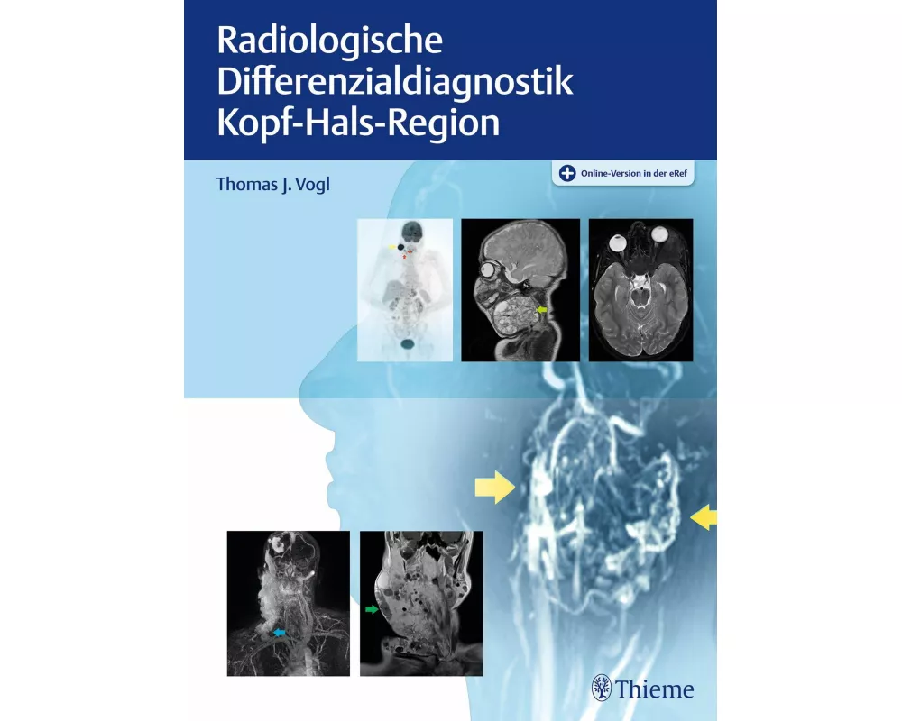 Radiologische Differenzialdiagnostik Kopf-Hals-Region