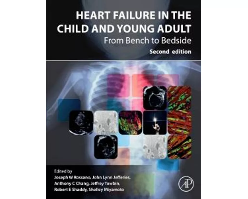 Heart Failure in the Child and Young Adult