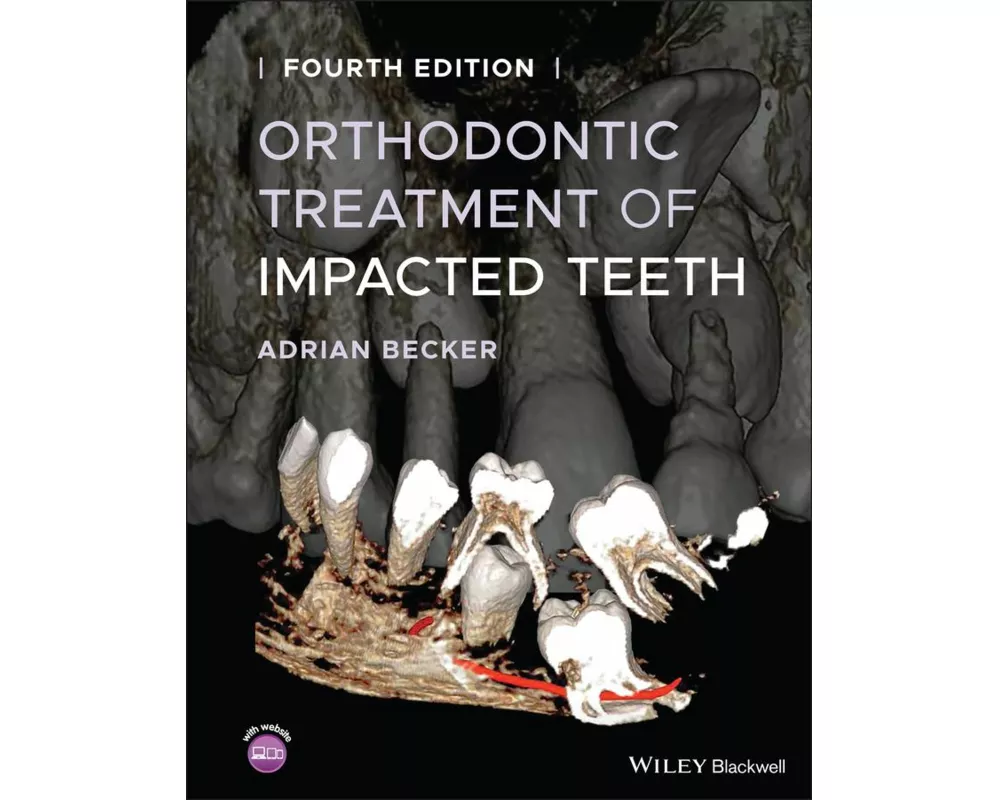 Orthodontic Treatment of Impacted Teeth