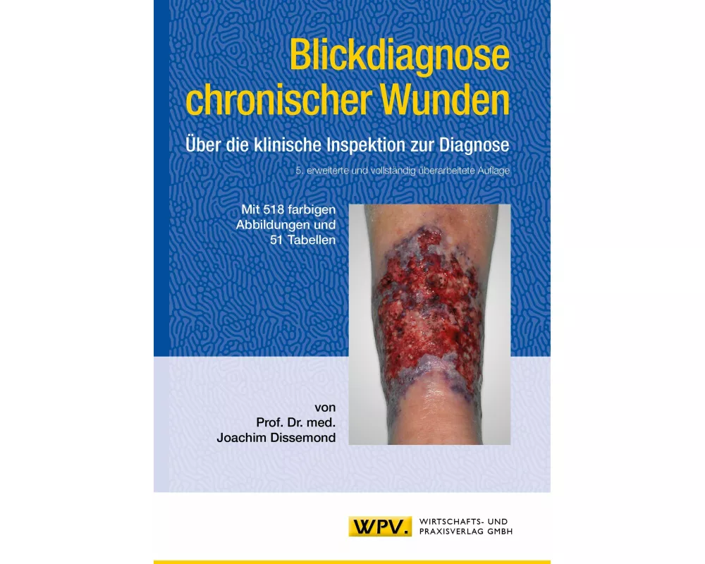 Blickdiagnose chronischer Wunden