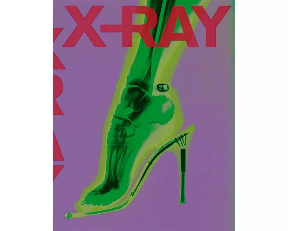 X-ray