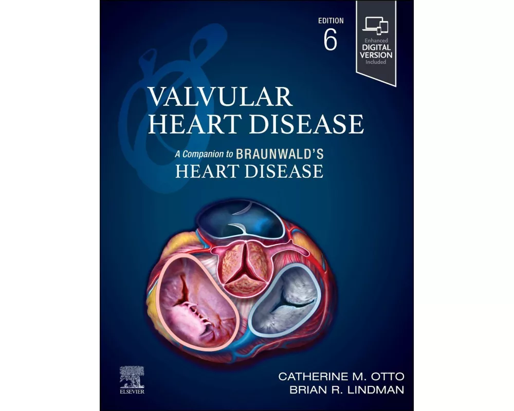 Valvular Heart Disease: A Companion to Braunwald's Heart Disease