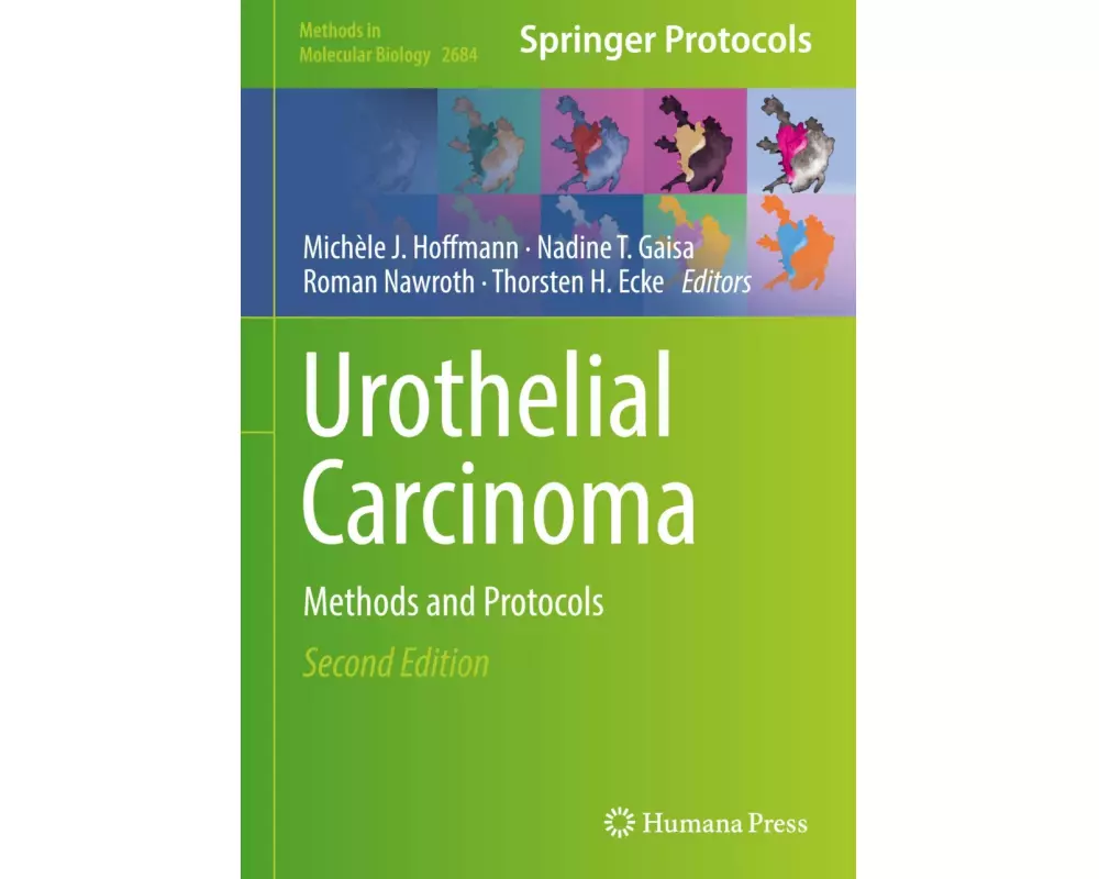 Urothelial Carcinoma