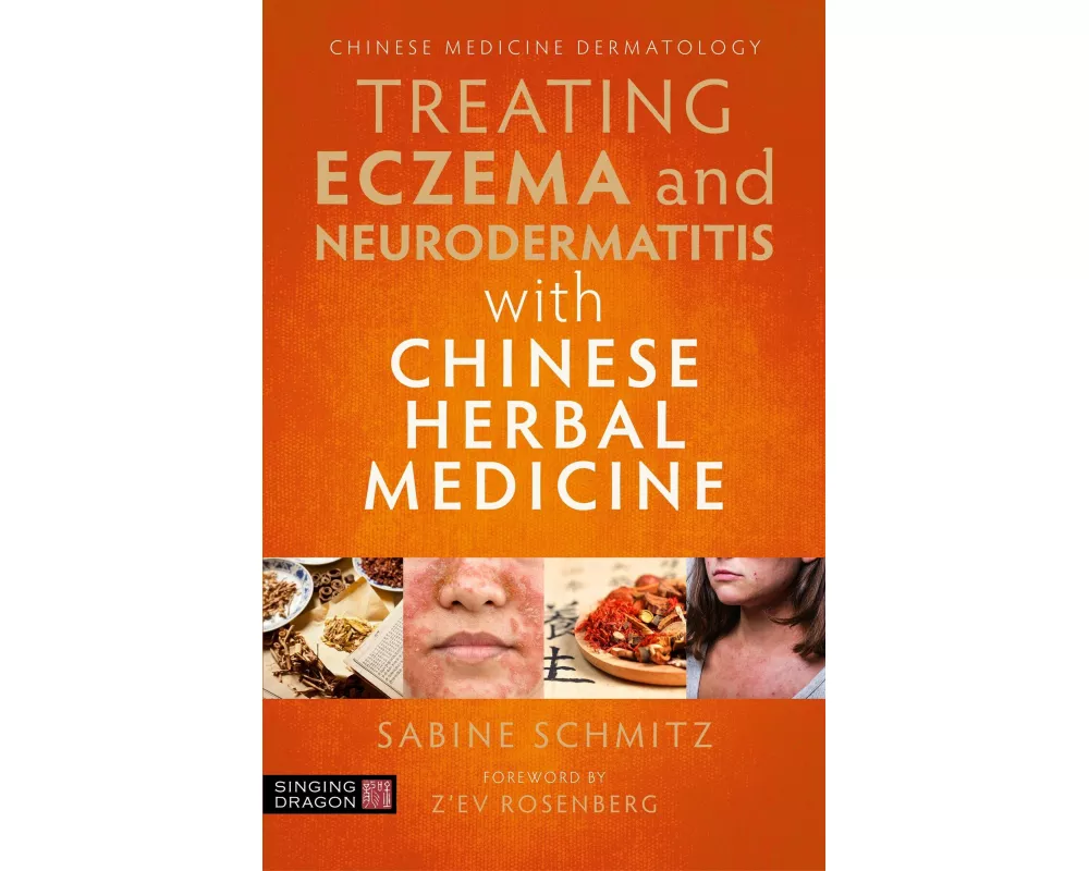 Treating Eczema and Neurodermatitis with Chinese Herbal Medicine