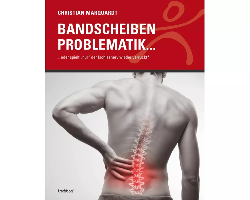 Bandscheiben Problematik