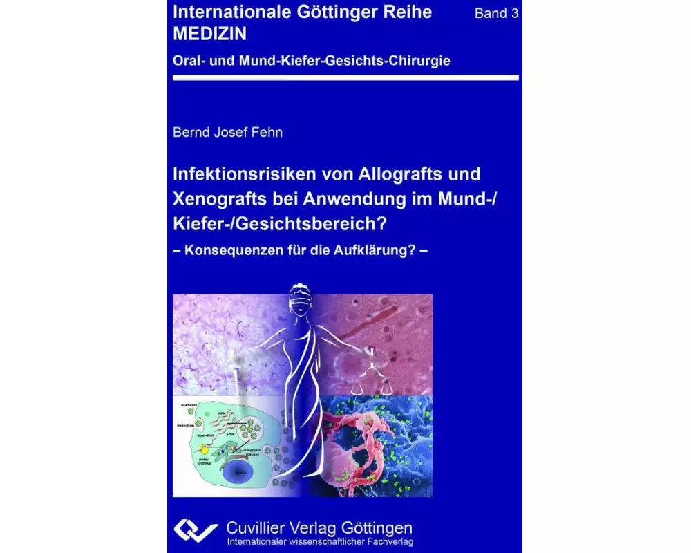 Infektionsrisiken von Allografts und Xenografts bei Anwendung im Mund-/Kiefer-/Gesichtsbereich?. Konsequenzen für die Aufklärung?