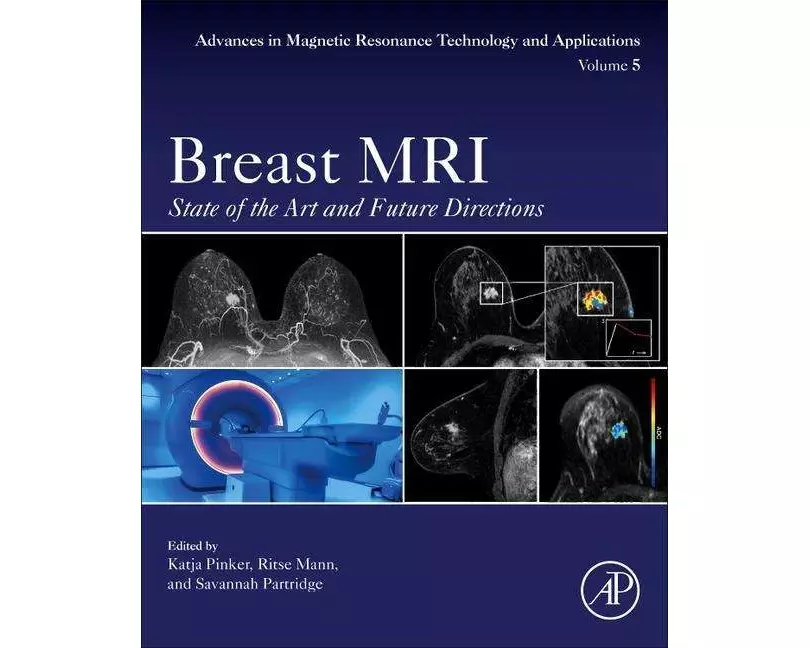 Breast MRI: Volume 5