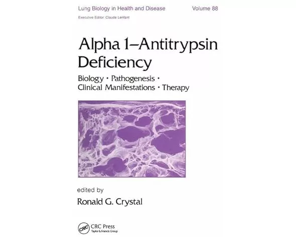 Alpha 1 - Antitrypsin Deficiency