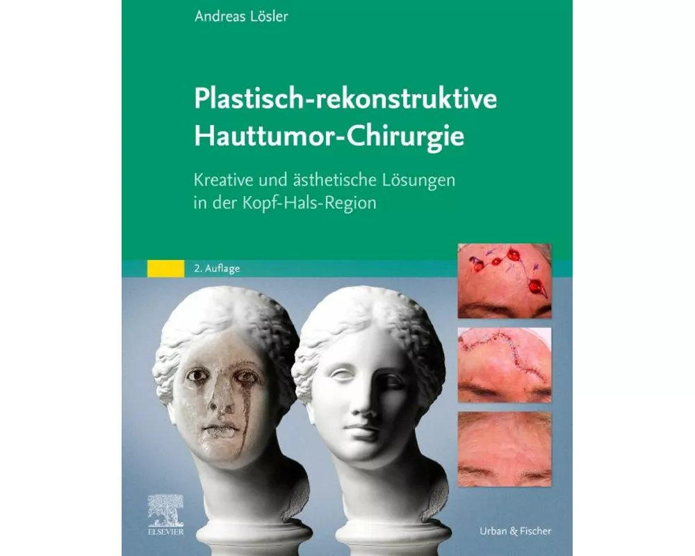Plastisch-rekonstruktive Hauttumor-Chirurgie