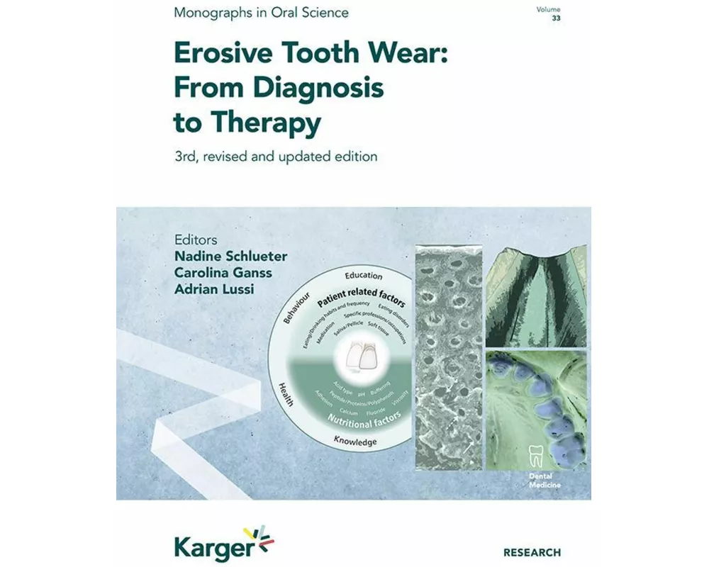 Erosive Tooth Wear: From Diagnosis to Therapy