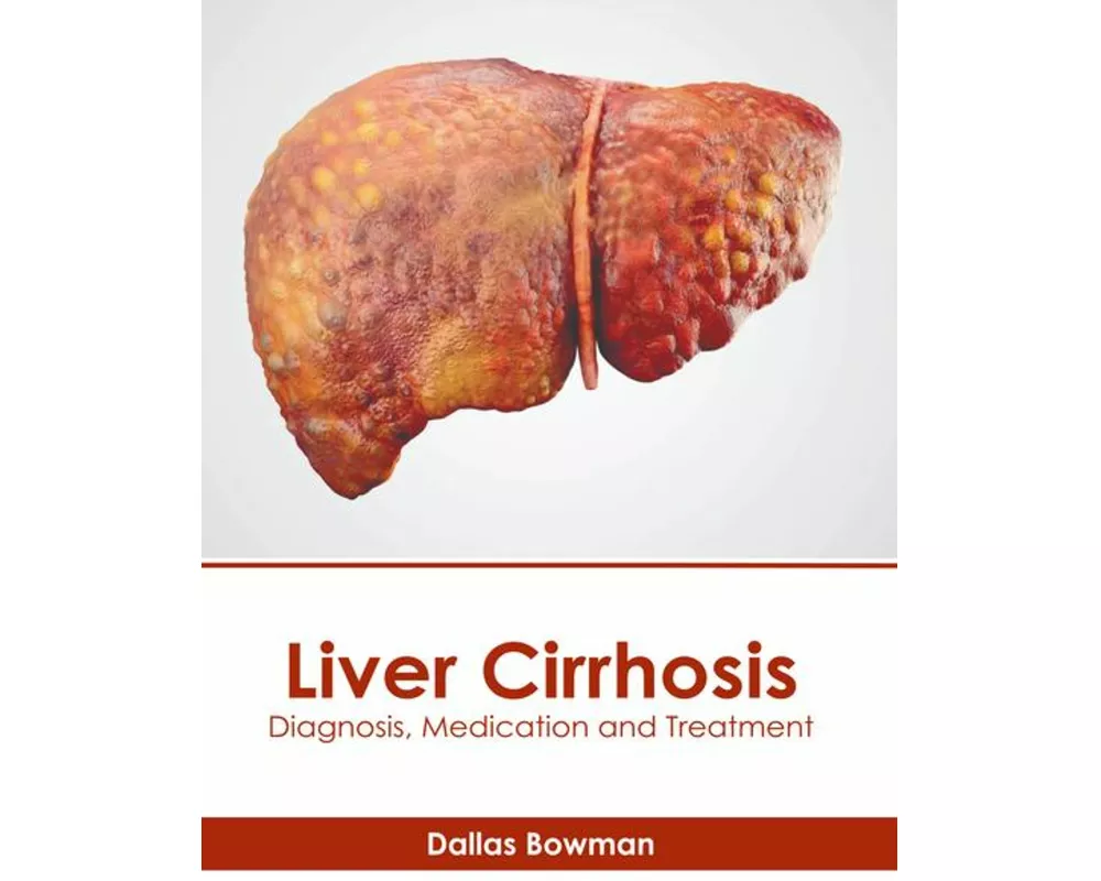 Liver Cirrhosis: Diagnosis, Medication and Treatment