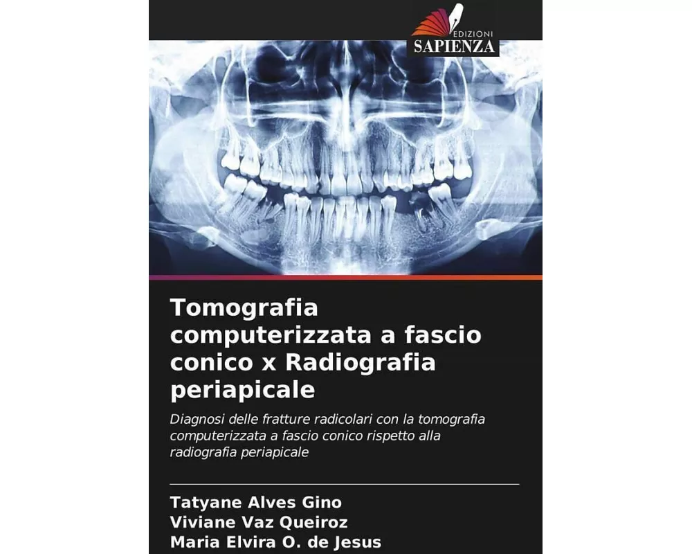 Tomografia computerizzata a fascio conico x Radiografia periapicale