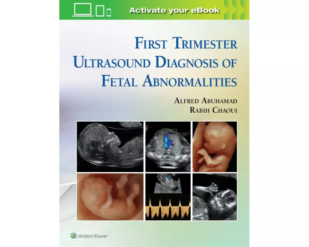First Trimester Ultrasound Diagnosis of Fetal Abnormalities