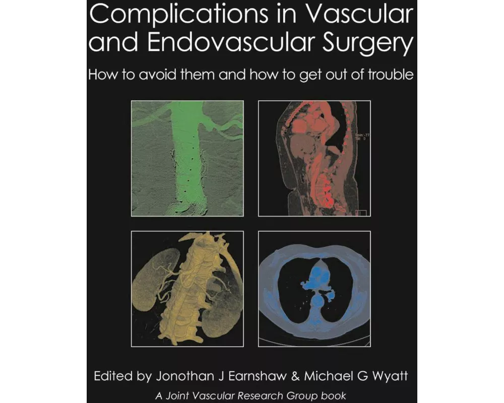 Complications in Vascular and Endovascular Surgery: How to Avoid Them and How to Get Out of Trouble