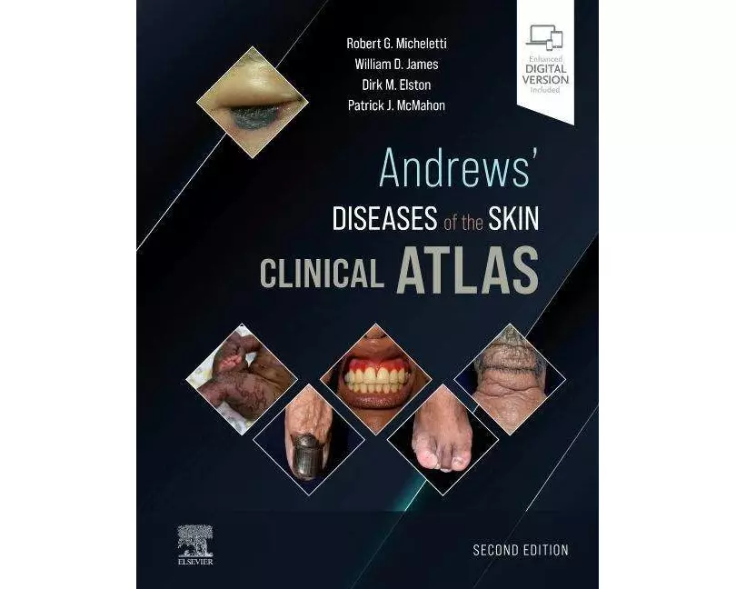 Andrews' Diseases of the Skin Clinical Atlas