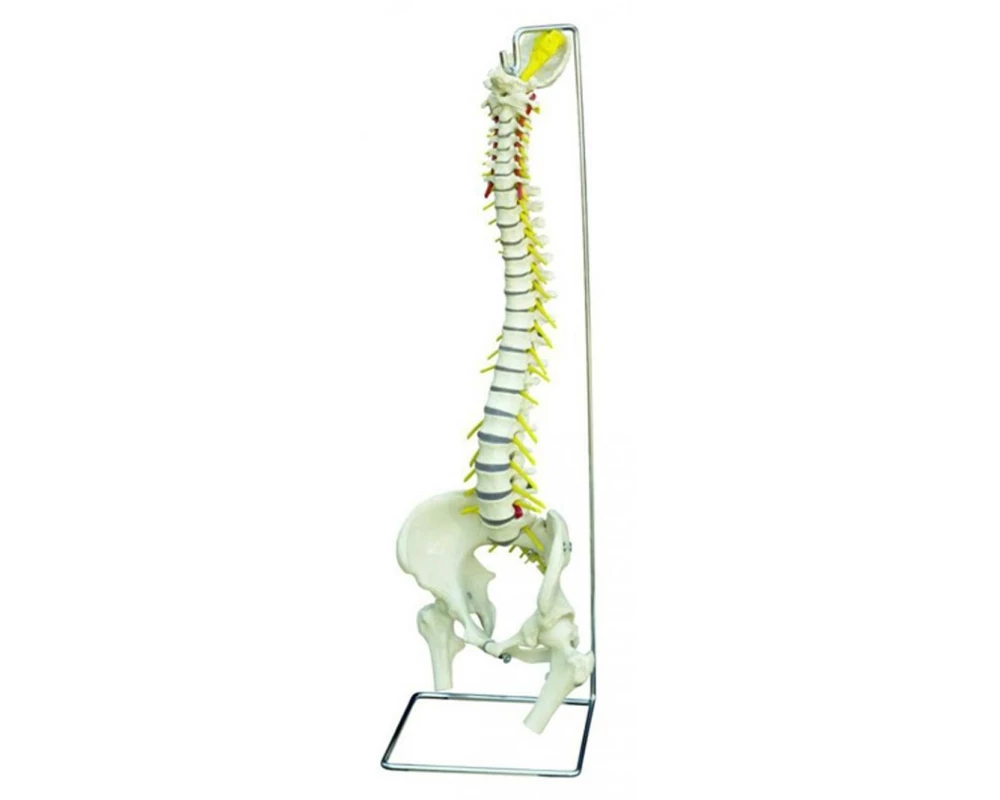 Rüdiger Skelett Wirbelsäule mit Bandscheibenvorfall