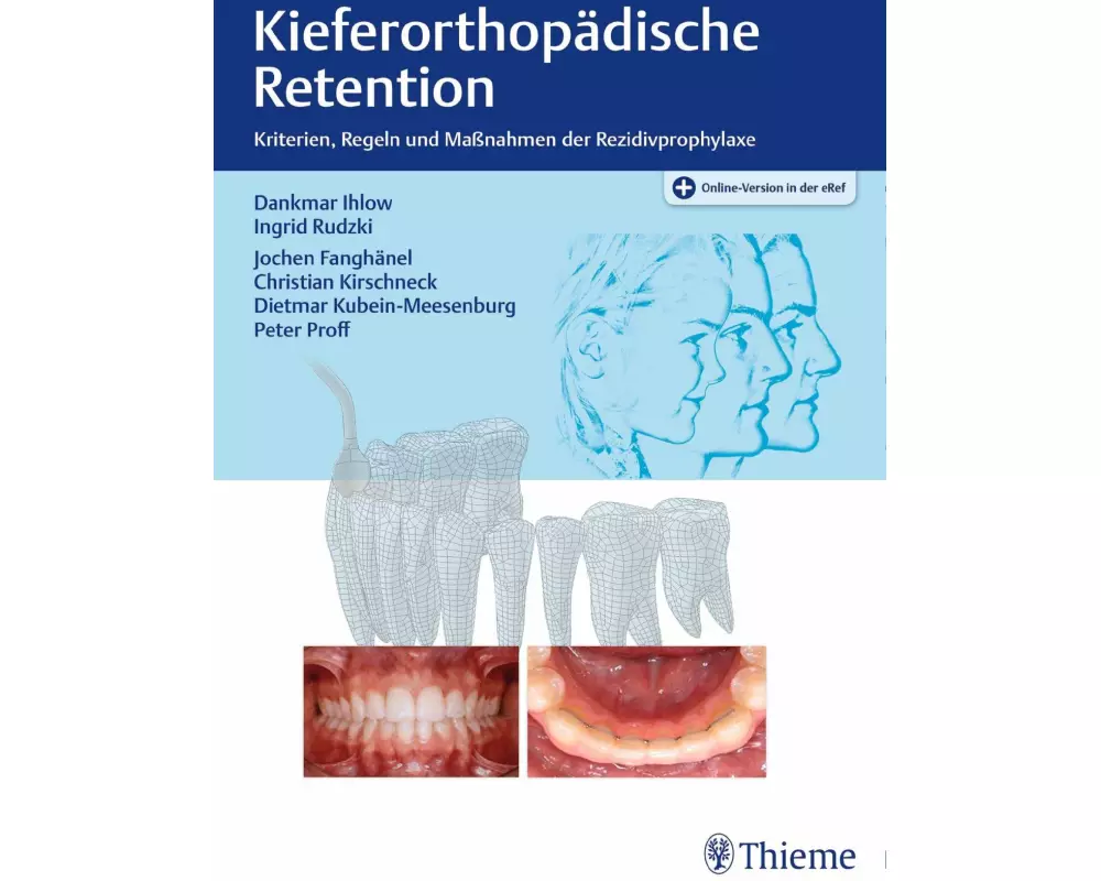 Kieferorthopädische Retention