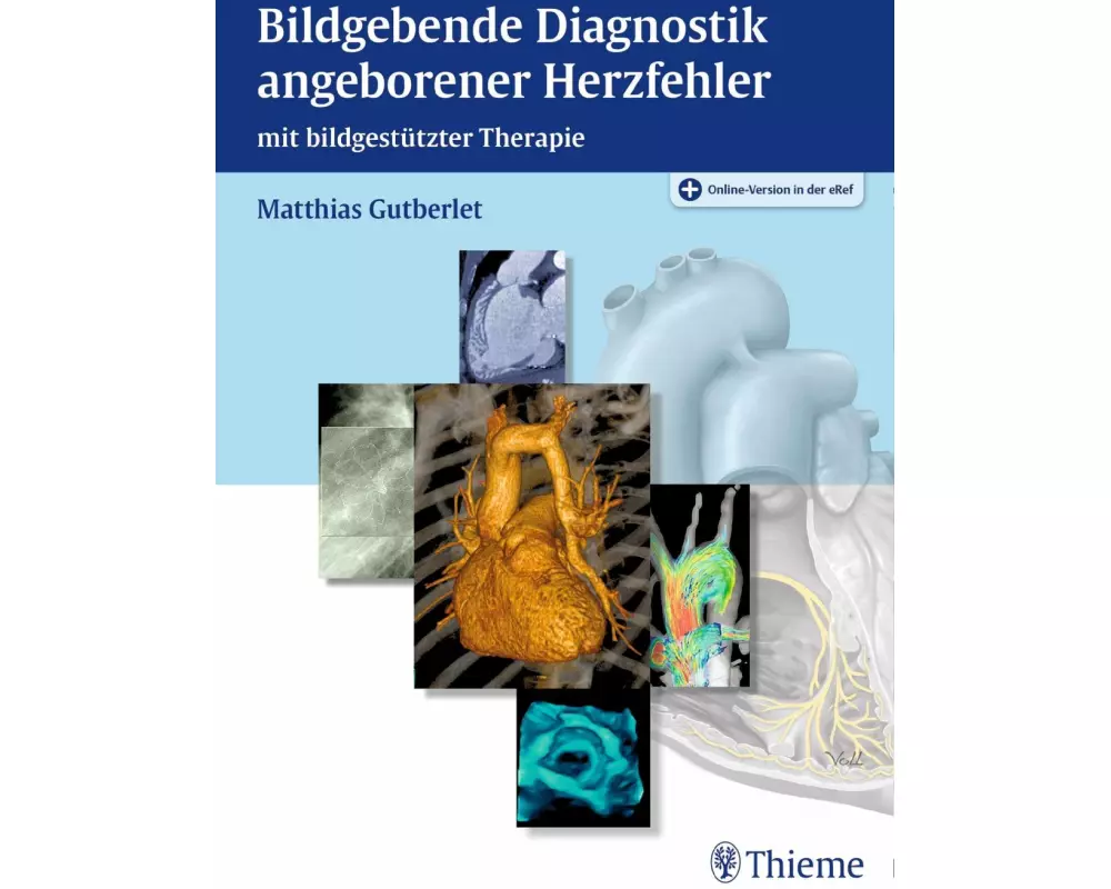 Bildgebende Diagnostik angeborener Herzfehler