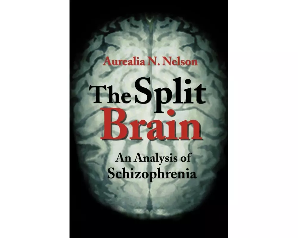 The Split Brain