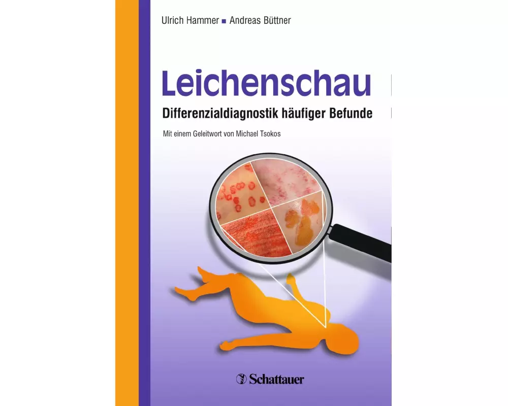 Leichenschau