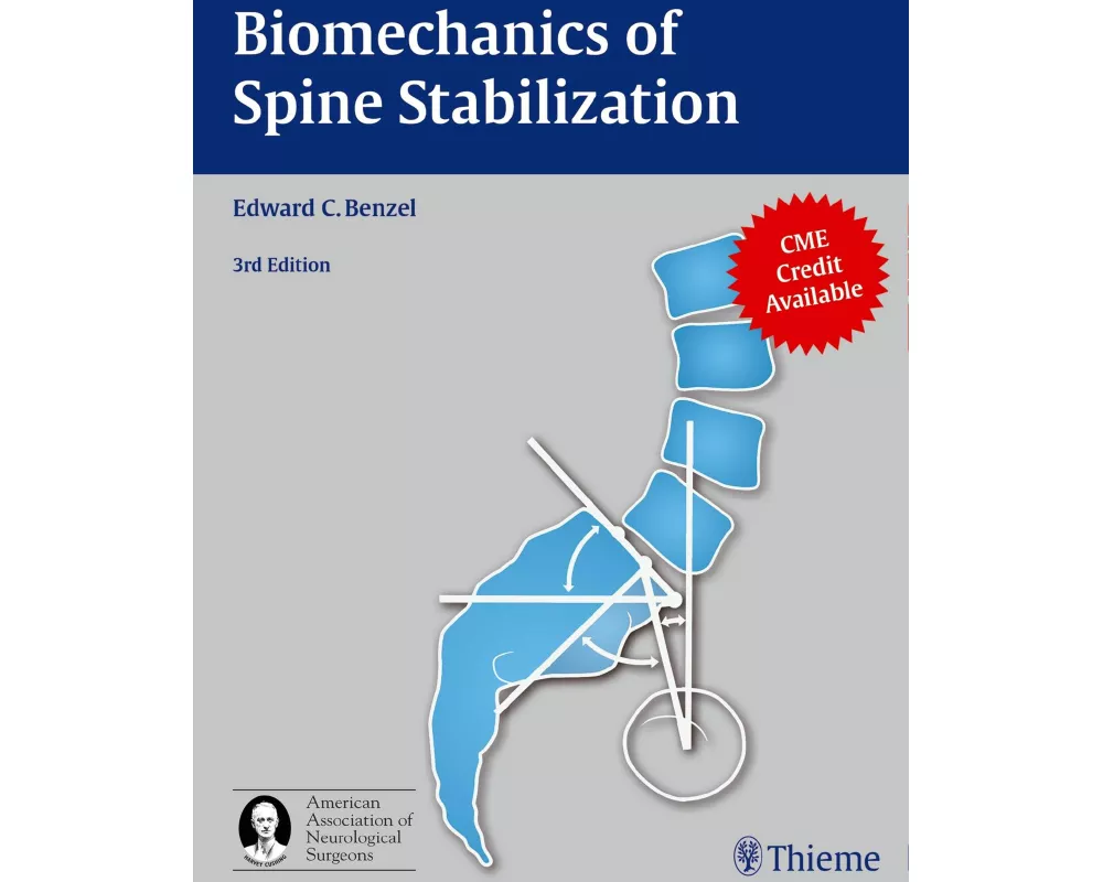 Biomechanics of Spine Stabilization