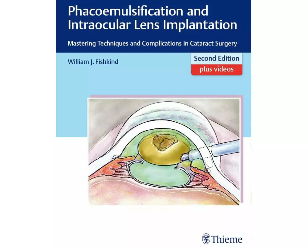 Phacoemulsification and Intraocular Lens Implantation