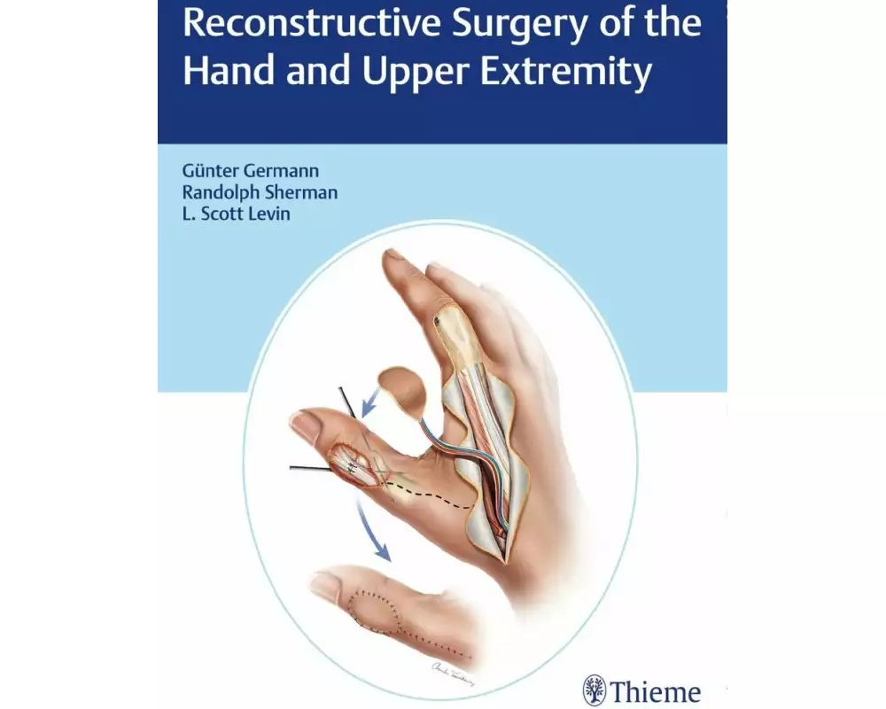 Reconstructive Surgery of the Hand and Upper Extremity