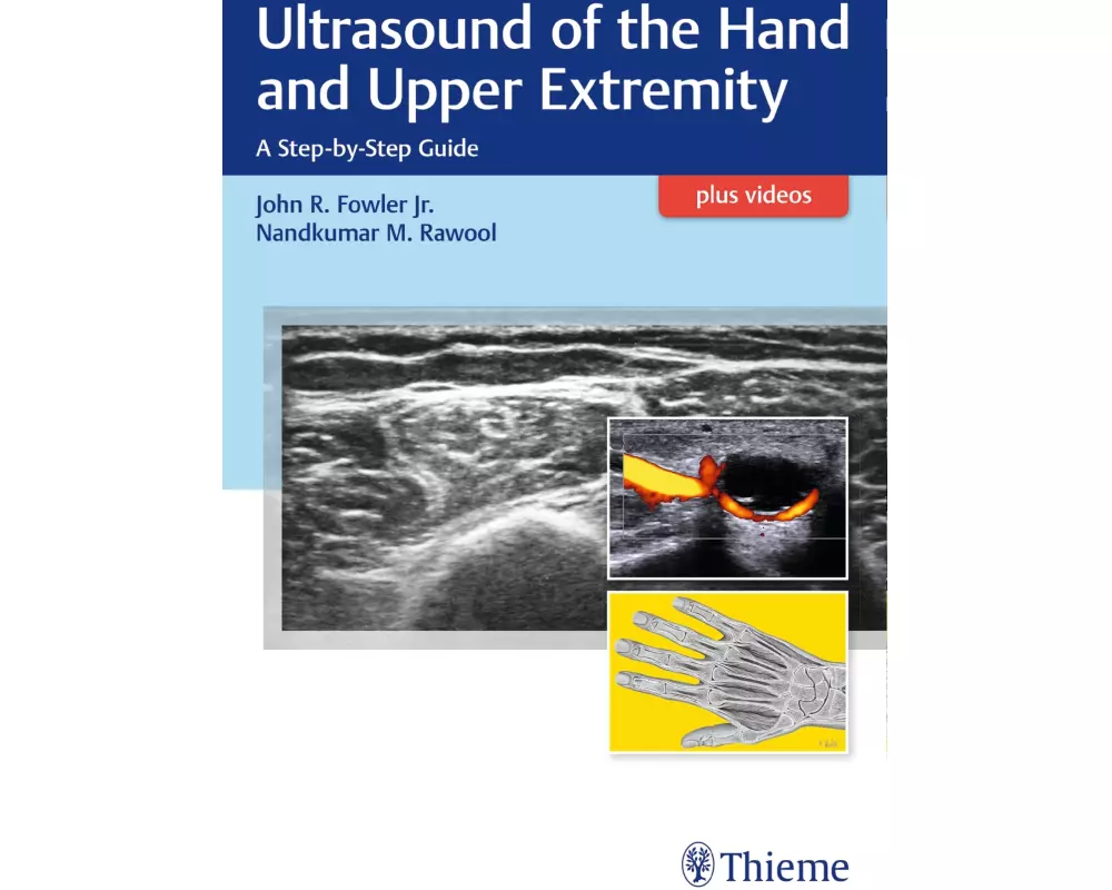 Ultrasound of the Hand and Upper Extremity