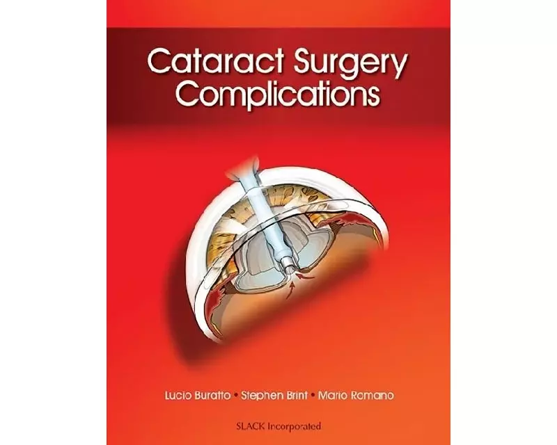 Cataract Surgery Complications