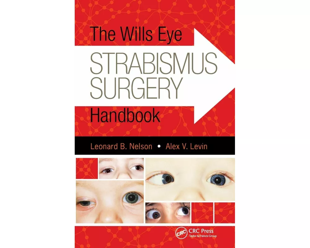 The Wills Eye Strabismus Surgery Handbook
