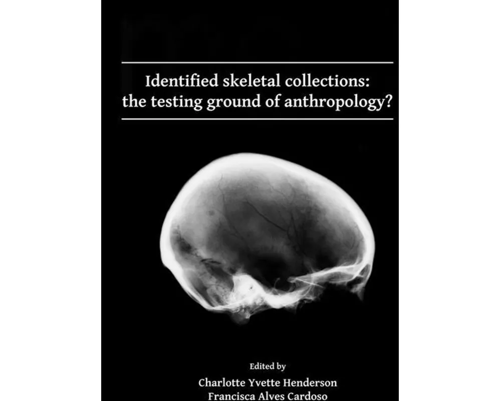 Identified skeletal collections: the testing ground of anthropology?