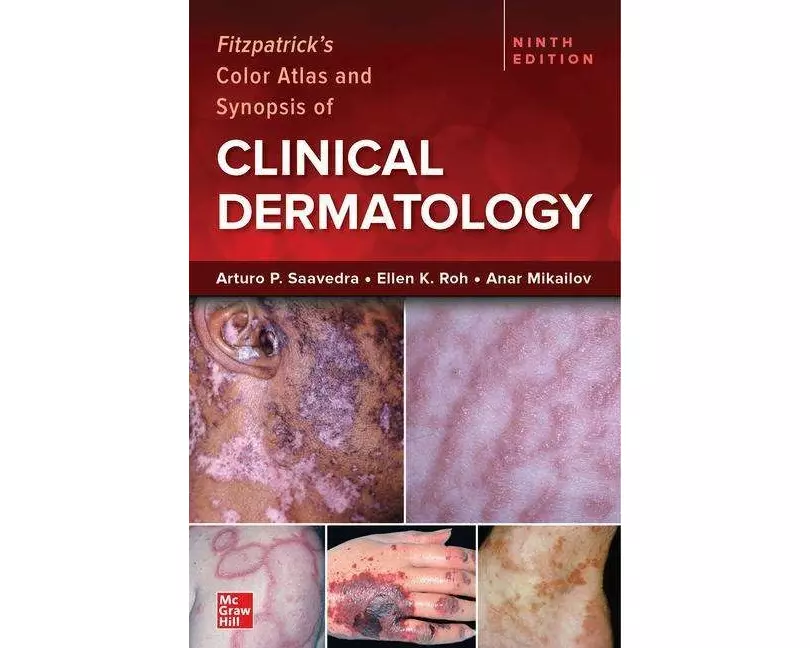 Fitzpatrick's Color Atlas and Synopsis of Clinical Dermatology, Ninth Edition