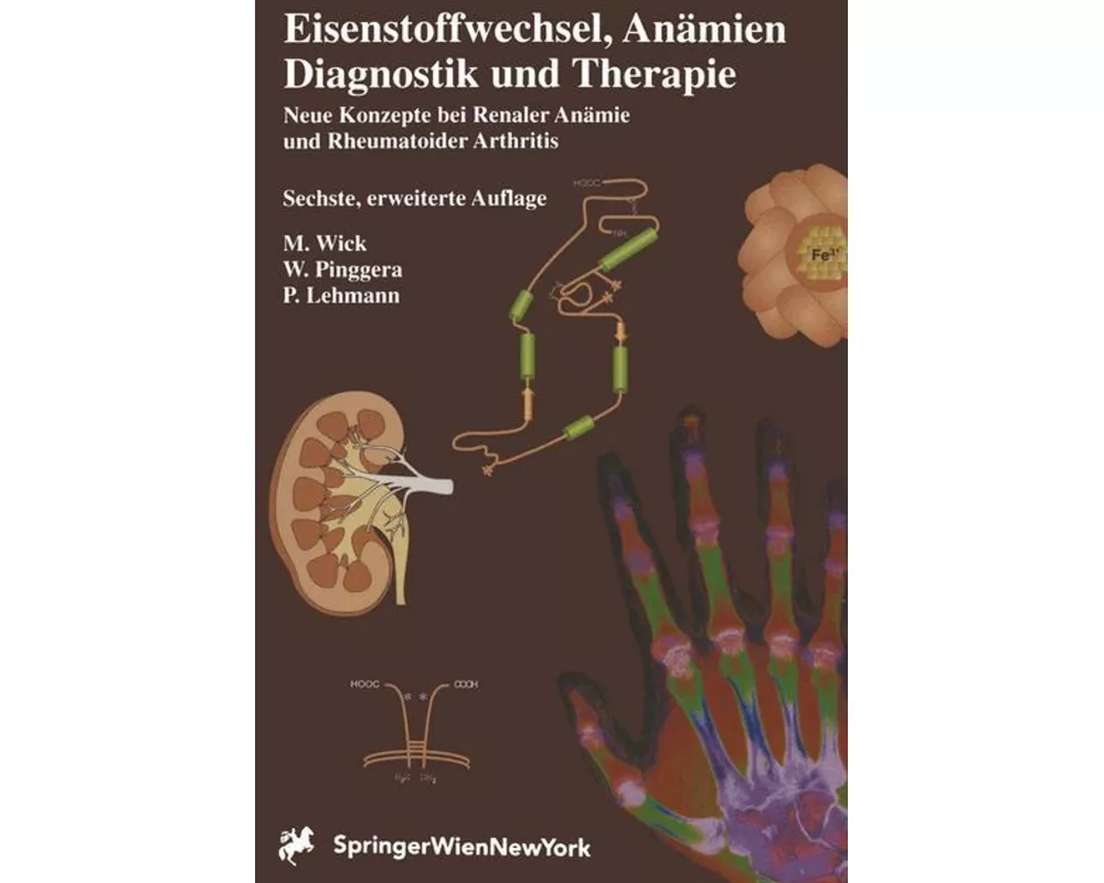 Eisenstoffwechsel, Anämien Therapie und Diagnose
