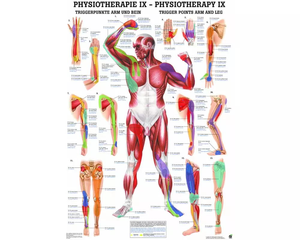 Rüdiger Anatomische Lehrtafel Triggerpunkte Arm und Bein